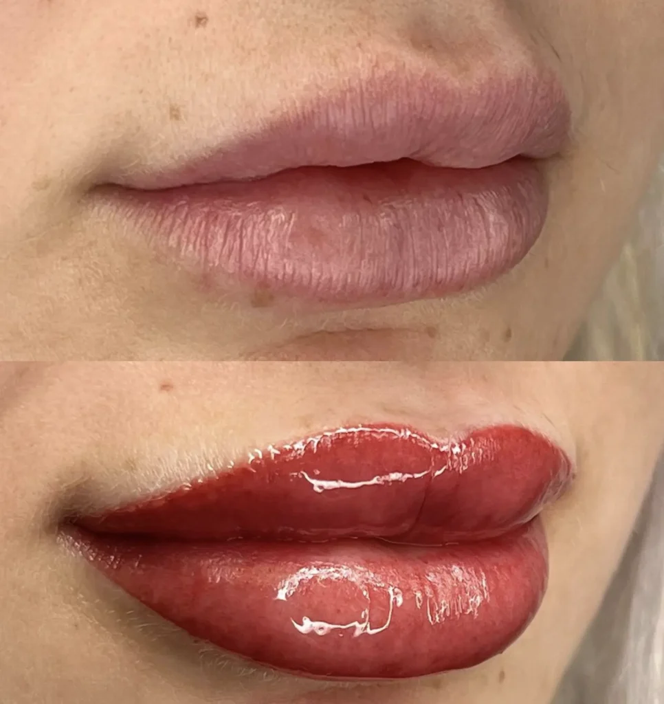 What Is Included in a Lip Tattoo Touch-Up?